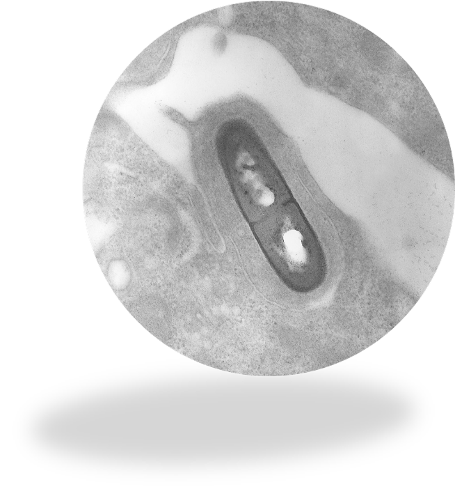 Listeria